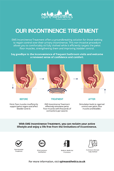 image to show how EMS treatment works for female urinary incontinence Canvey Island