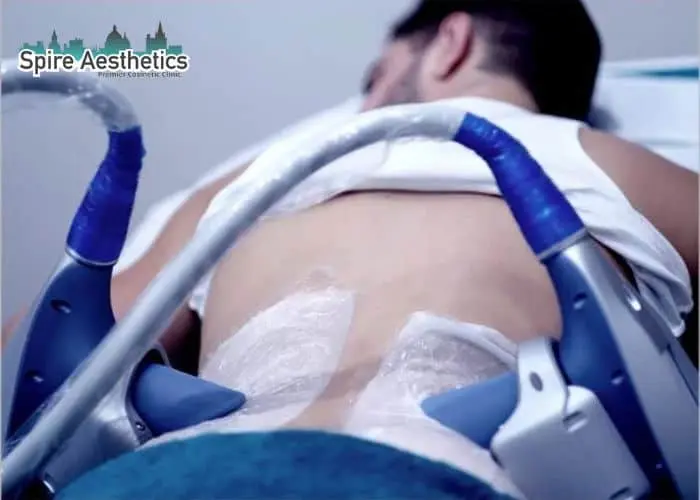 Man having fat freezing treatment done on love handles before a competitions Canvey Island to create a sculpted look.